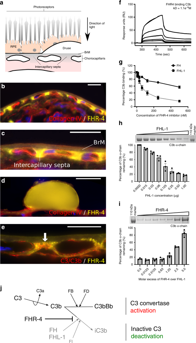 Fig. 2: Accumulation of FHR-4 in the choriocapillaris inhibits C3b breakdown.