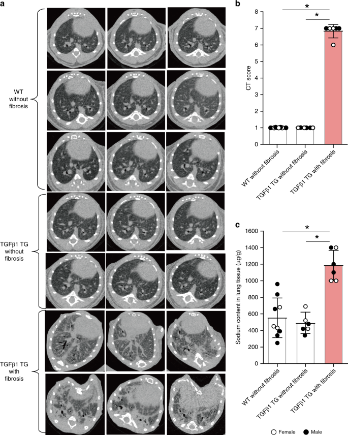 A Staphylococcus Pro Apoptotic Peptide Induces Acute Exacerbation Of Pulmonary Fibrosis Nature Communications