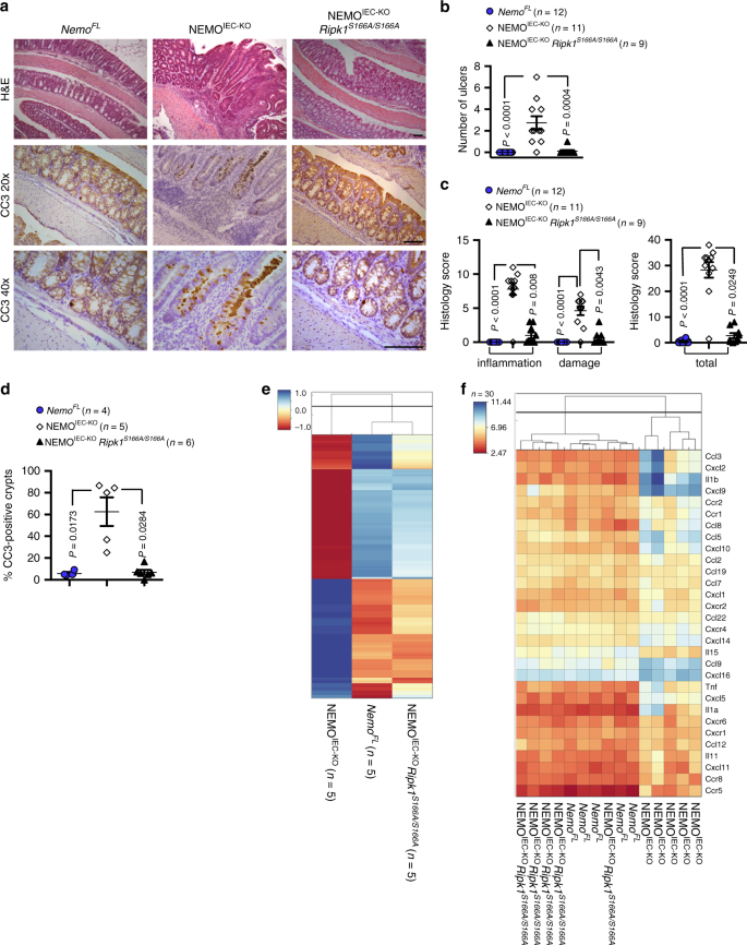 Fig. 3: S166 phosphorylation is essential for RIPK1-dependent intestinal inflammation in NEMOIEC-KO mice.
