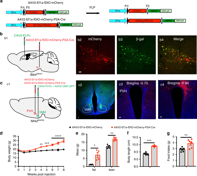 TrkB-expressing paraventricular hypothalamic neurons suppress appetite  through multiple neurocircuits