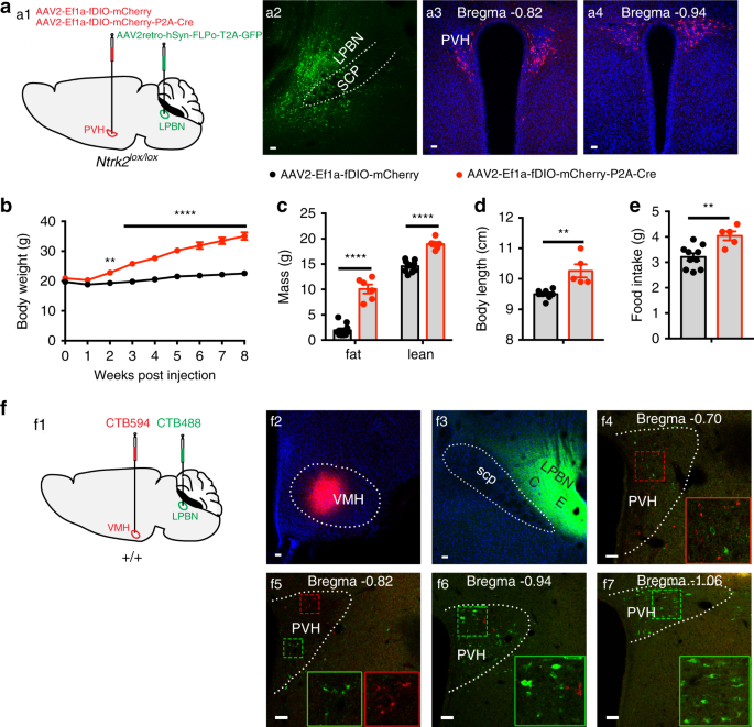 TrkB-expressing paraventricular hypothalamic neurons suppress appetite  through multiple neurocircuits