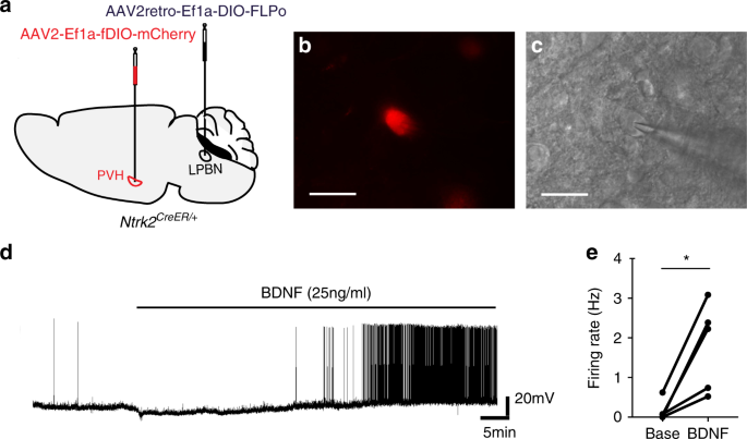 TrkB-expressing paraventricular hypothalamic neurons suppress