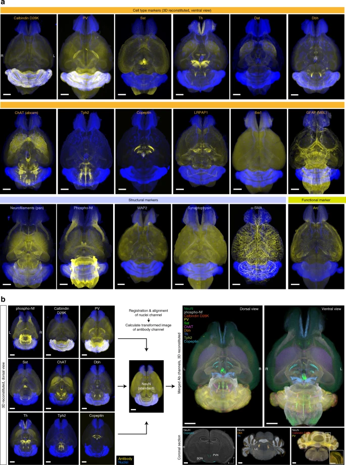 Результаты сканирования мозга различными красителями и антителами