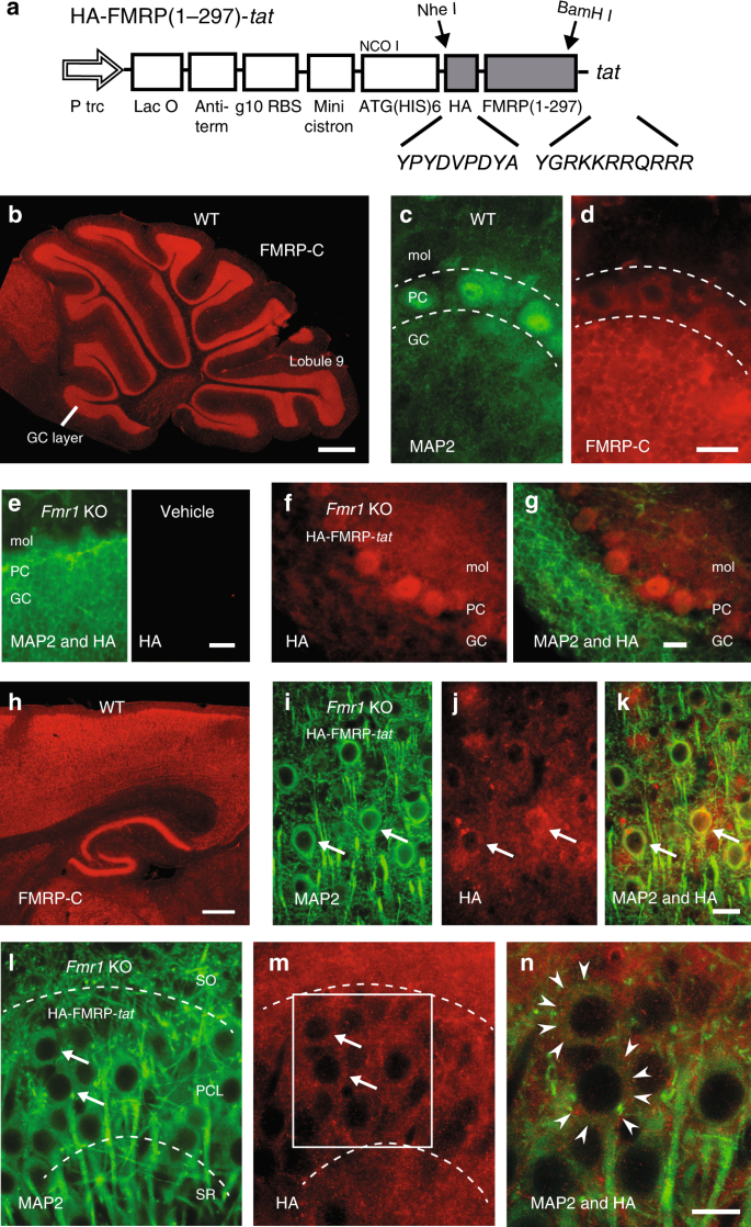 FMRP(1–297)-tat restores ion channel and synaptic function in a