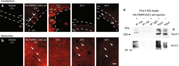 FMRP(1–297)-tat restores ion channel and synaptic function in a