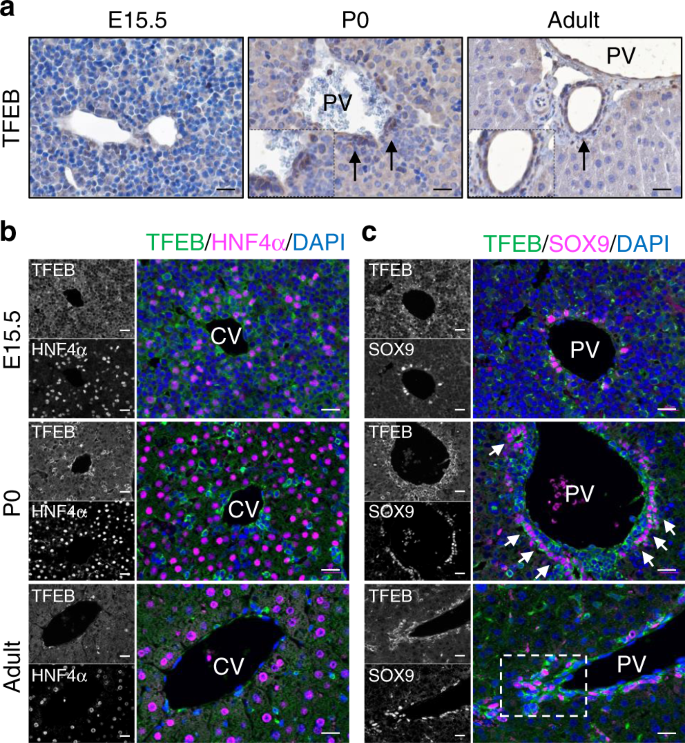 TFEB regulates murine liver cell fate during development and regeneration |  Nature Communications