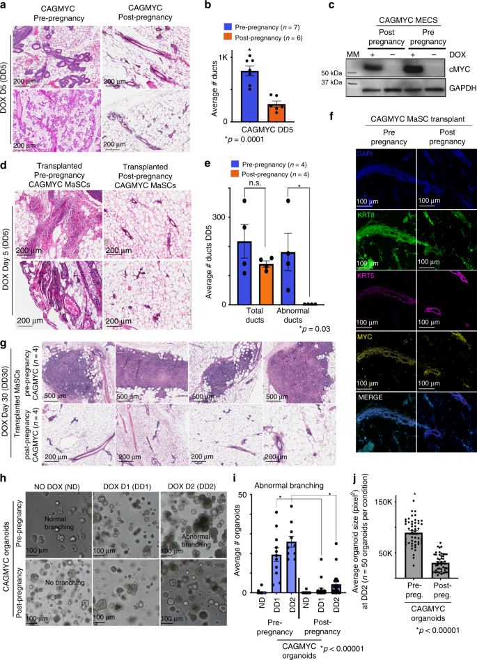 Pregnancy Reprograms The Epigenome Of Mammary Epithelial Cells And Blocks The Development Of Premalignant Lesions | Nature Communications Pregnancy Reprograms The Epigenome Of Mammary Epithelial Cells And Blocks The Development Of Premalignant Lesions | Nature Communications