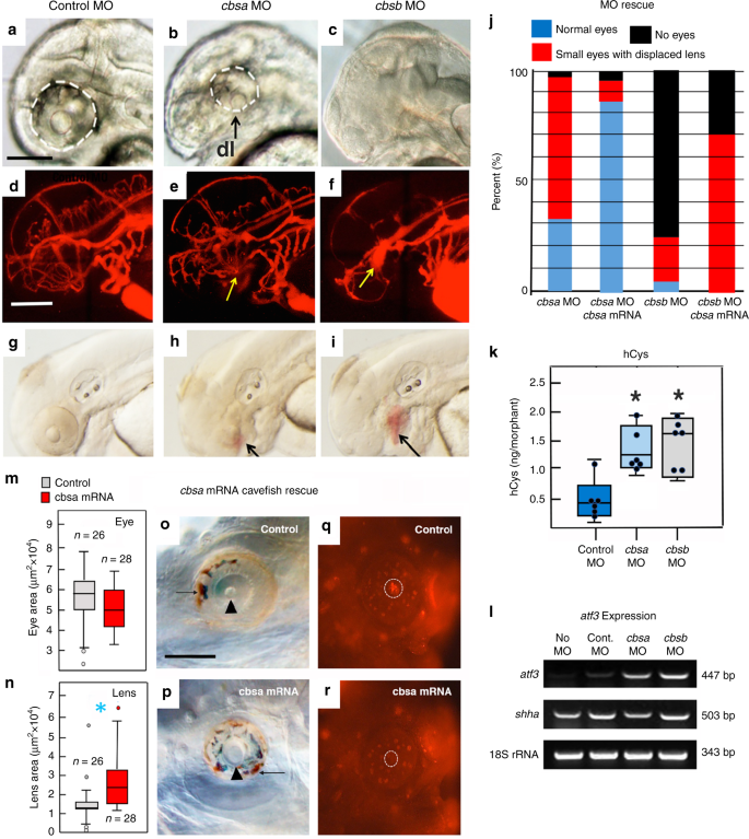 A Hypomorphic Cystathionine Ss Synthase Gene Contributes To Cavefish Eye Loss By Disrupting Optic Vasculature Nature Communications