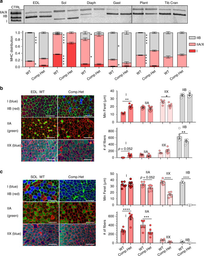 Fig. 4: Myosin heavy chain (MHC) isoform distribution and CSA analysis.
