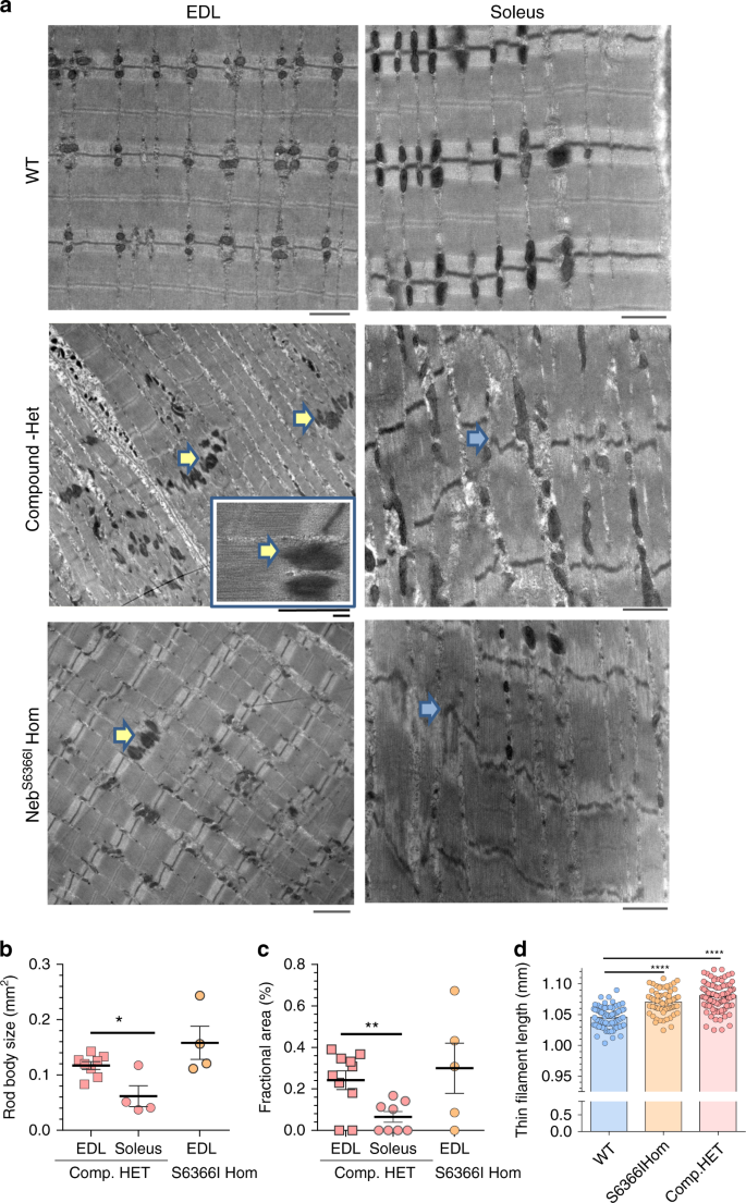 Fig. 5: Nemaline rod bodies, sarcomeric ultrastructure, and thin filament length.