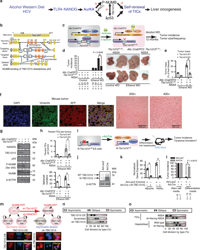 Fig. 1: TBC1D15 inhibits hepatocyte differentiation, maintain symmetric cell division, and promotes oncogenesis.