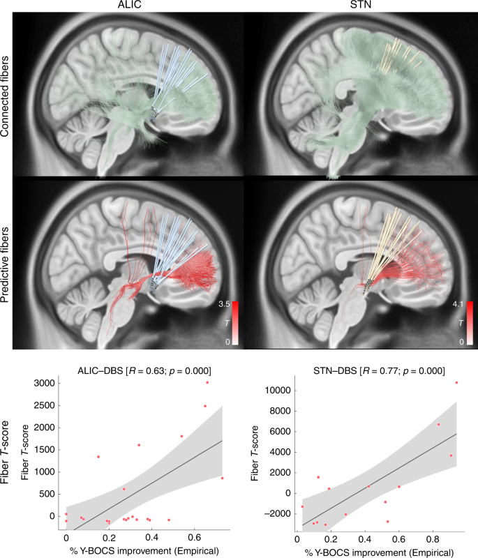 Fig. 2: Predictive fiber tracts in training cohorts.