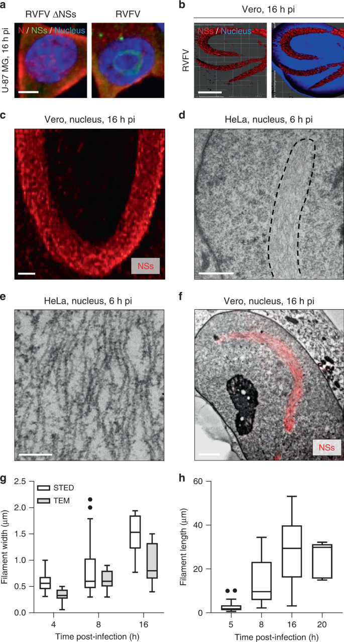 NSs amyloid formation is associated with the virulence of Rift Valley fever  virus in mice | Nature Communications