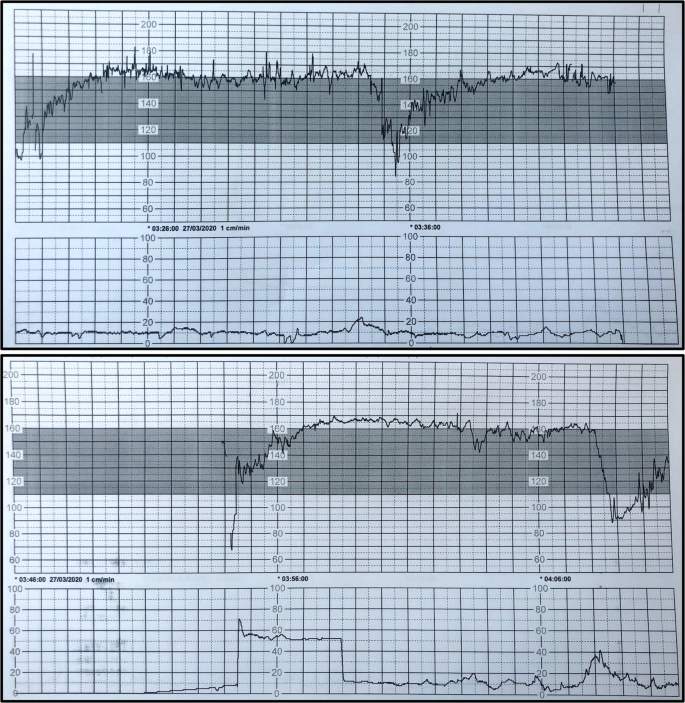 figure1