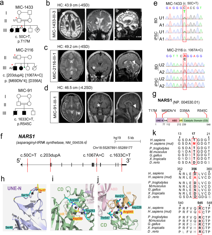 Loss Of Nars1 Impairs Progenitor Proliferation In Cortical Brain Organoids And Leads To Microcephaly Nature Communications