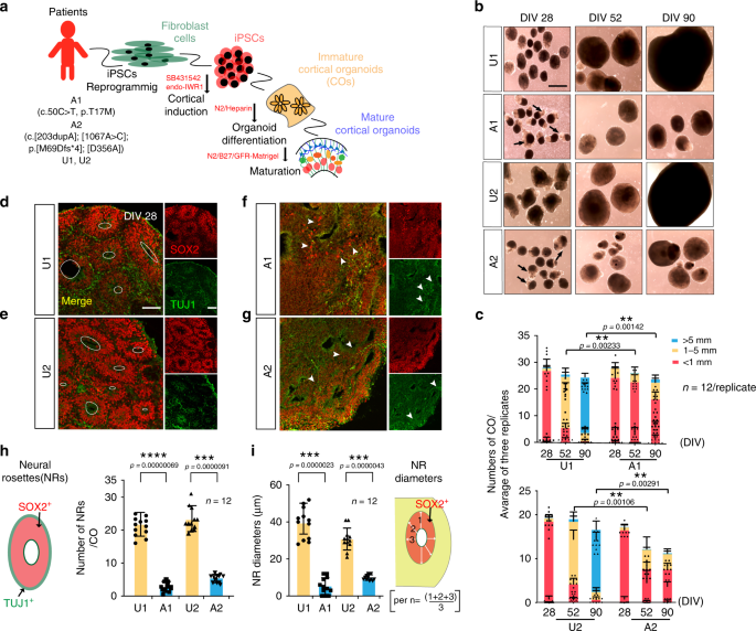 Loss Of Nars1 Impairs Progenitor Proliferation In Cortical Brain Organoids And Leads To Microcephaly Nature Communications