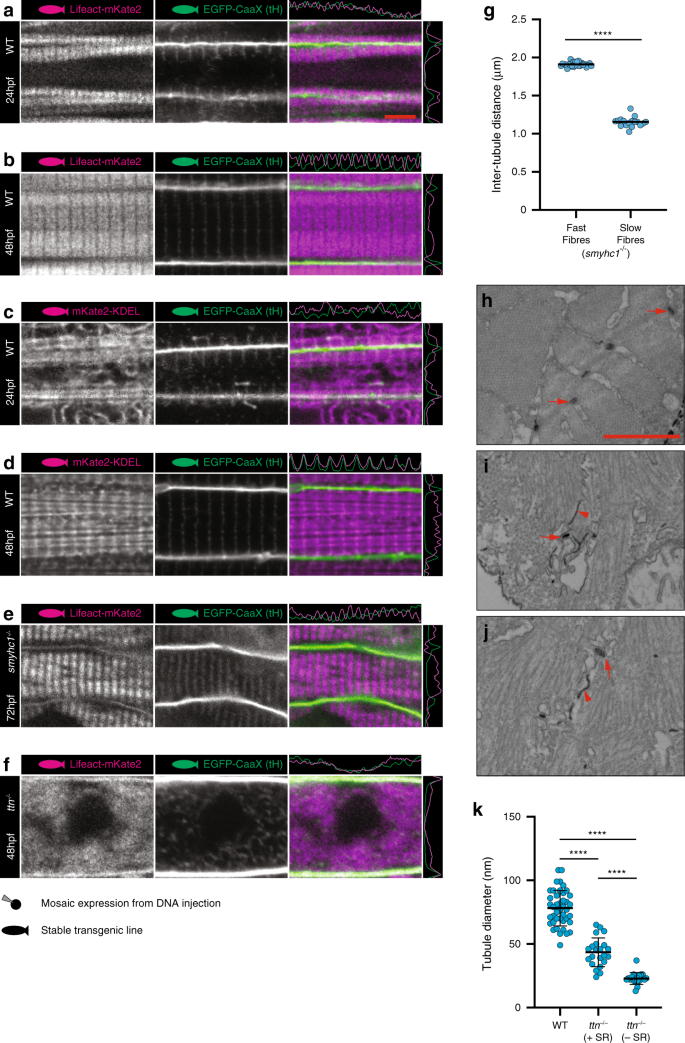 Fig. 4: Sarcomere formation and sarcoplasmic reticulum.