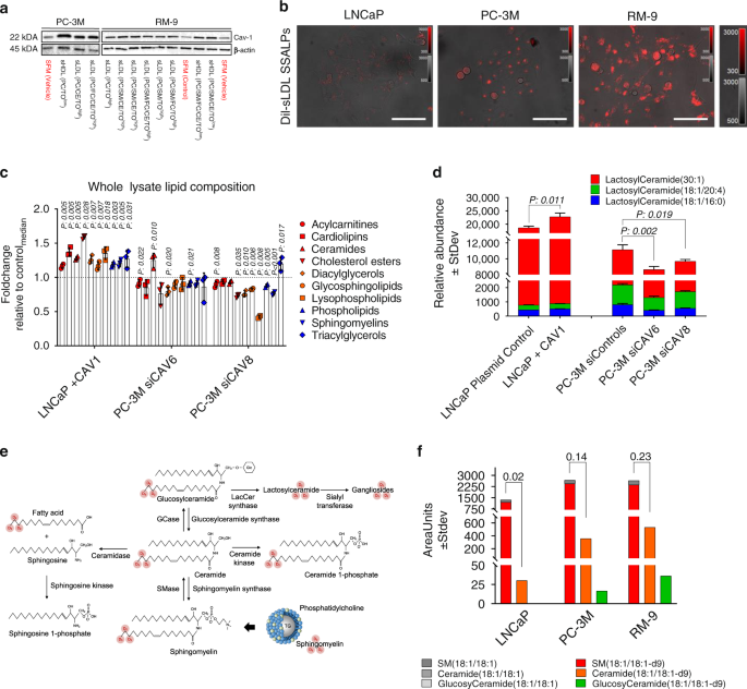 Fig. 2: Cav-1 regulates sphingolipid metabolism.