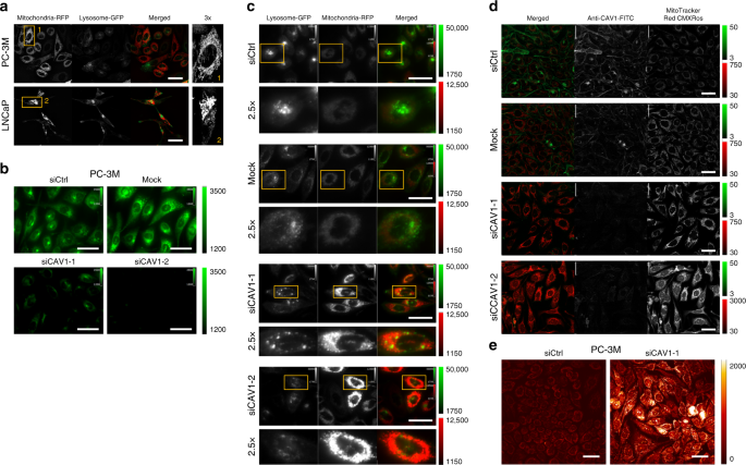 Fig. 4: Cav-1 promotes mitochondrial turnover.