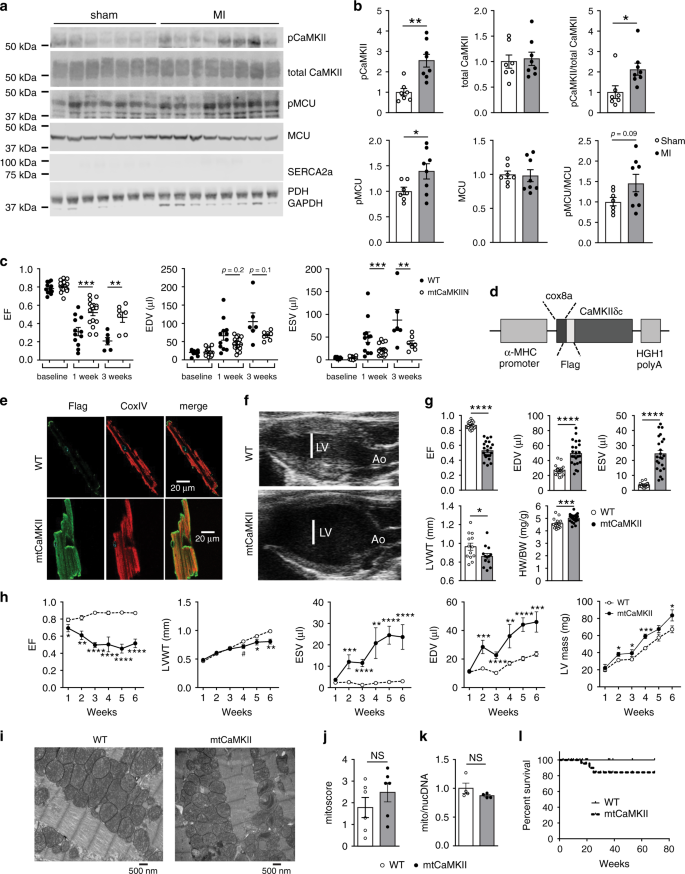 Mitochondrial Camkii Causes Adverse Metabolic Reprogramming And Dilated Cardiomyopathy Nature Communications