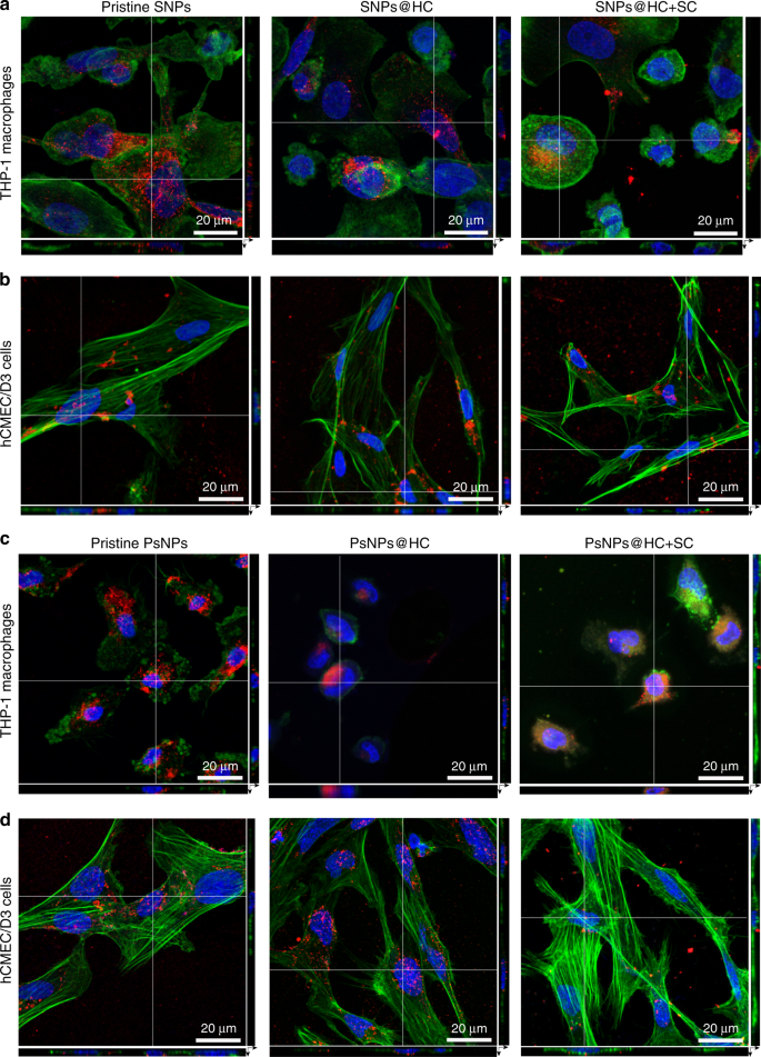 Fig. 6: CLSM images confirm the uptake of nanoparticles.