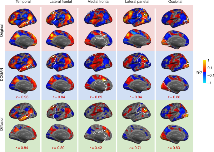 Fig. 3: The DCGAN-generated functional connectivity maps are highly similar to the original maps, throughout cortex.