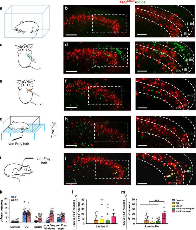 A Spinal Neural Circuitry For Converting Touch To Itch Sensation Nature Communications