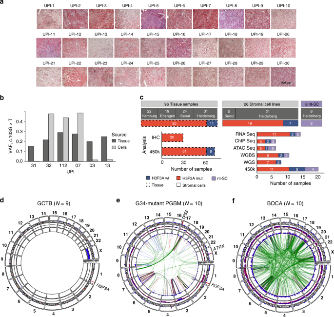 Fig. 1: Initial characterization of GCTB patient samples.