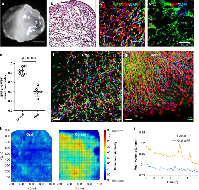 Injury Triggers Fascia Fibroblast Collective Cell Migration To Drive Scar Formation Through N Cadherin Nature Communications