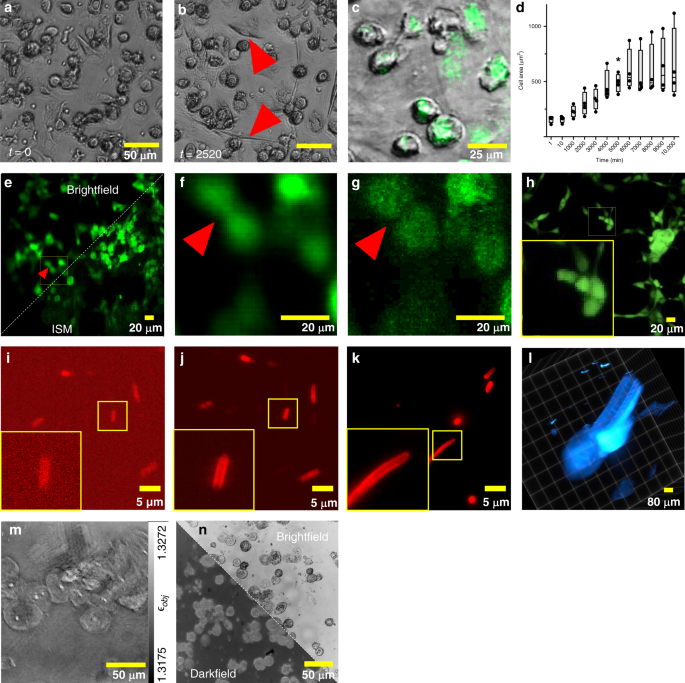 A versatile and customizable low-cost 3D-printed open standard for  microscopic imaging | Nature Communications