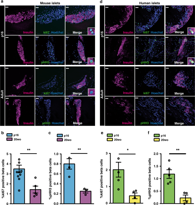 Wisp1 Is A Circulating Factor That Stimulates Proliferation Of Adult Mouse And Human Beta Cells Nature Communications