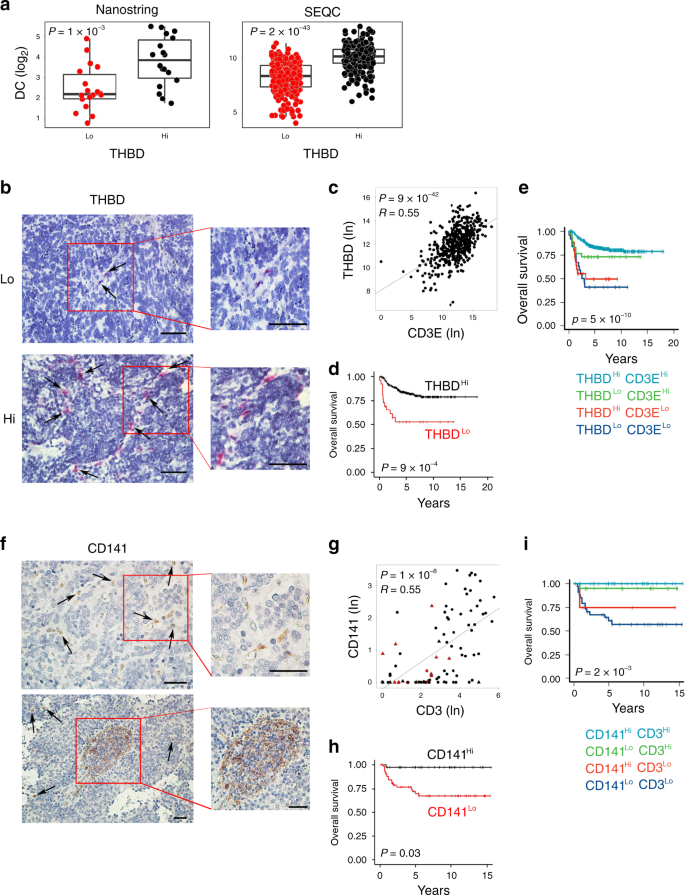 Fig. 3: Intratumoral DC levels correlate with increased survival in human neuroblastoma.