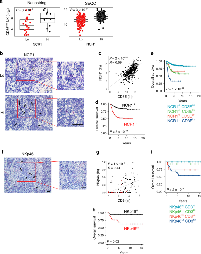 Fig. 4: Intratumoral NK-cell levels correlate with increased survival in human neuroblastoma.