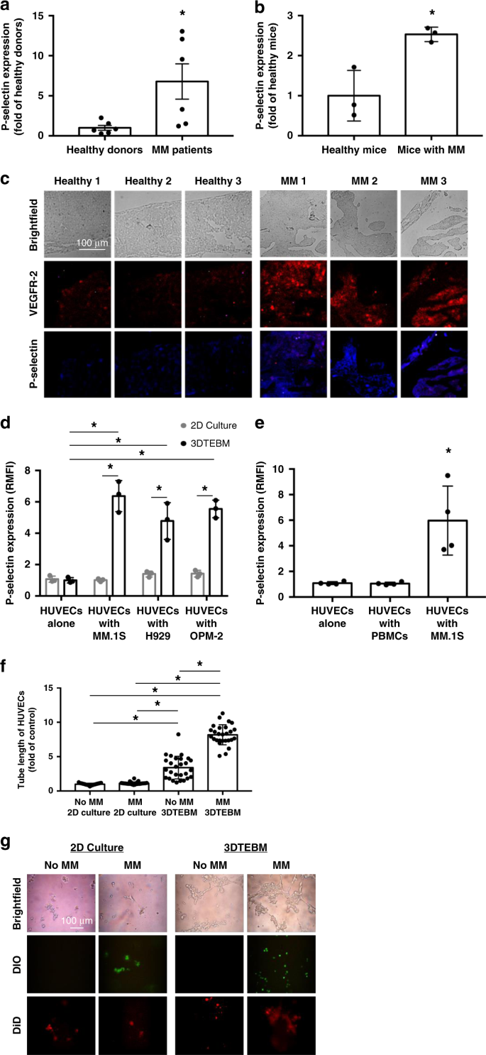 Tumor Microenvironment Targeted Nanoparticles Loaded With Bortezomib And Rock Inhibitor Improve Efficacy In Multiple Myeloma Nature Communications