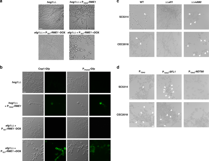 Fig. 6: Regulators of morphogenesis influence chlamydosporulation through Rme1.