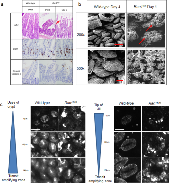 A Rac Gef Network Critical For Early Intestinal Tumourigenesis Nature Communications A Rac Gef Network Critical For Early Intestinal Tumourigenesis Nature Communications