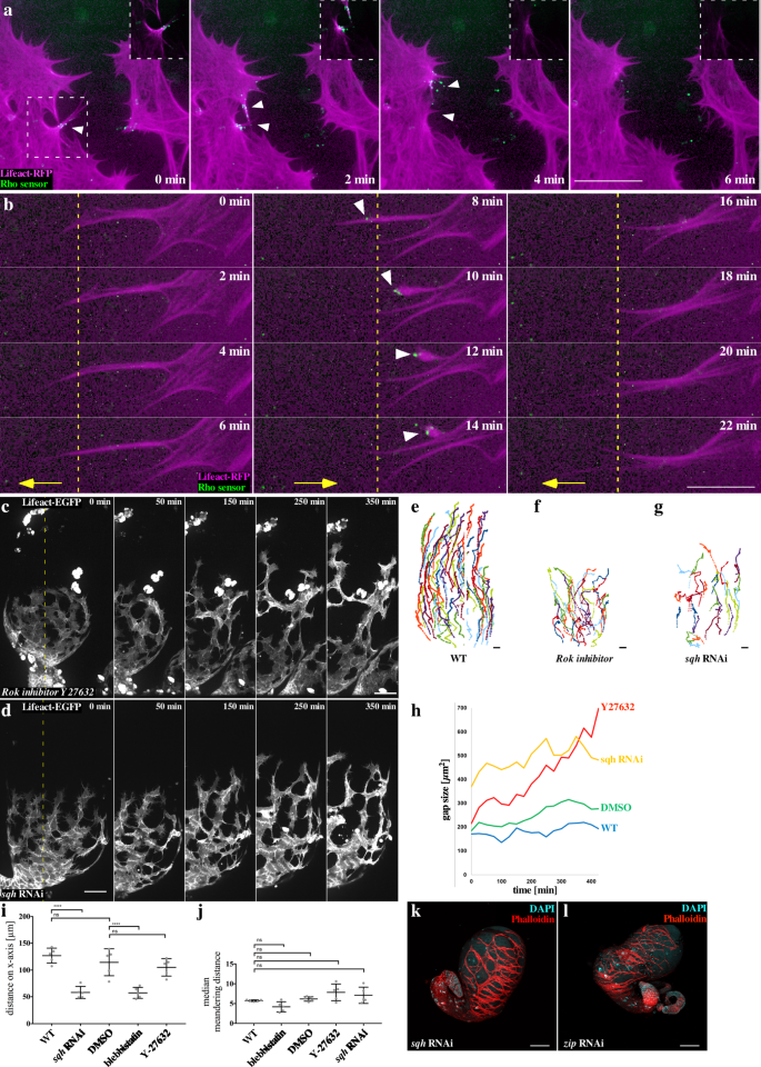 Fig. 7: Rho/Rok-driven actomyosin contractility is essential for myotube migration.