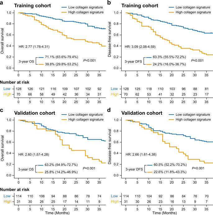 Predicting Postoperative Peritoneal Metastasis In Gastric Cancer With Serosal Invasion Using A Collagen Nomogram Nature Communications