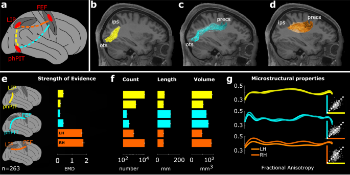 brain scan visualization showing attention activation during presentation openings with orange highlighted regions