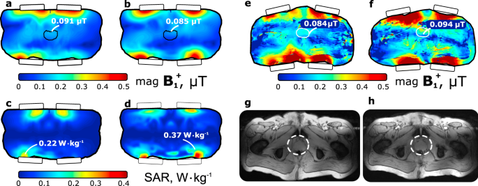 A Self Matched Leaky Wave Antenna For Ultrahigh Field Magnetic Resonance Imaging With Low Specific Absorption Rate Nature Communications