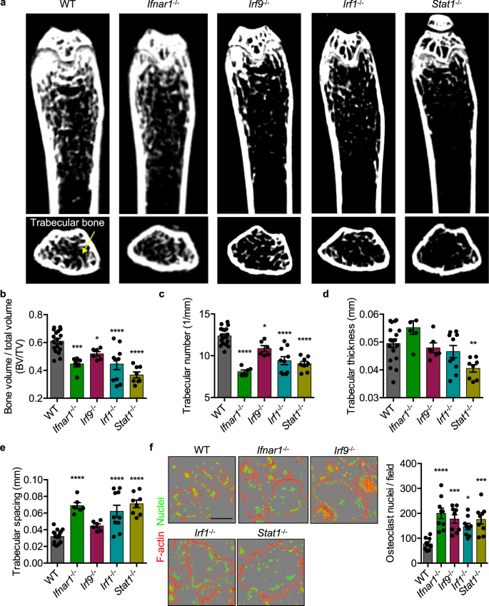 Osteoclast Fusion And Bone Loss Are Restricted By Interferon Inducible Guanylate Binding Proteins Nature Communications