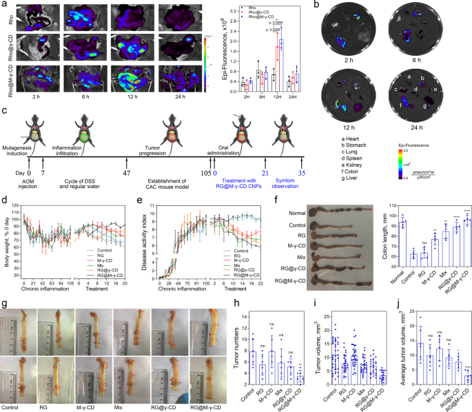 Cyclodextrin-based host-guest complexes loaded with regorafenib for  colorectal cancer treatment | Nature Communications