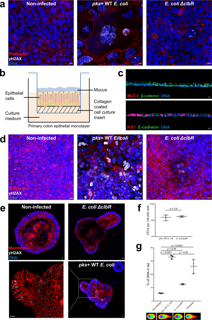 Genomic Aberrations After Short Term Exposure To Colibactin Producing E Coli Transform Primary Colon Epithelial Cells Nature Communications