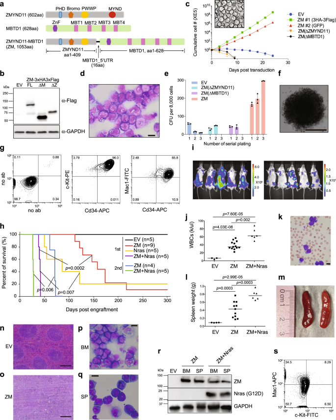 Zmynd11 Mbtd1 Induces Leukemogenesis Through Hijacking Nua4 Tip60 Acetyltransferase Complex And A Pwwp Mediated Chromatin Association Mechanism Nature Communications Zmynd11 Mbtd1 Induces Leukemogenesis Through Hijacking Nua4 Tip60 Acetyltransferase Complex And A Pwwp Mediated Chromatin Association Mechanism Nature Communications