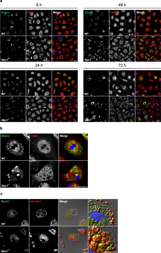 Fig. 5: Npc1−/− microglia display impairment in myelin turnover.