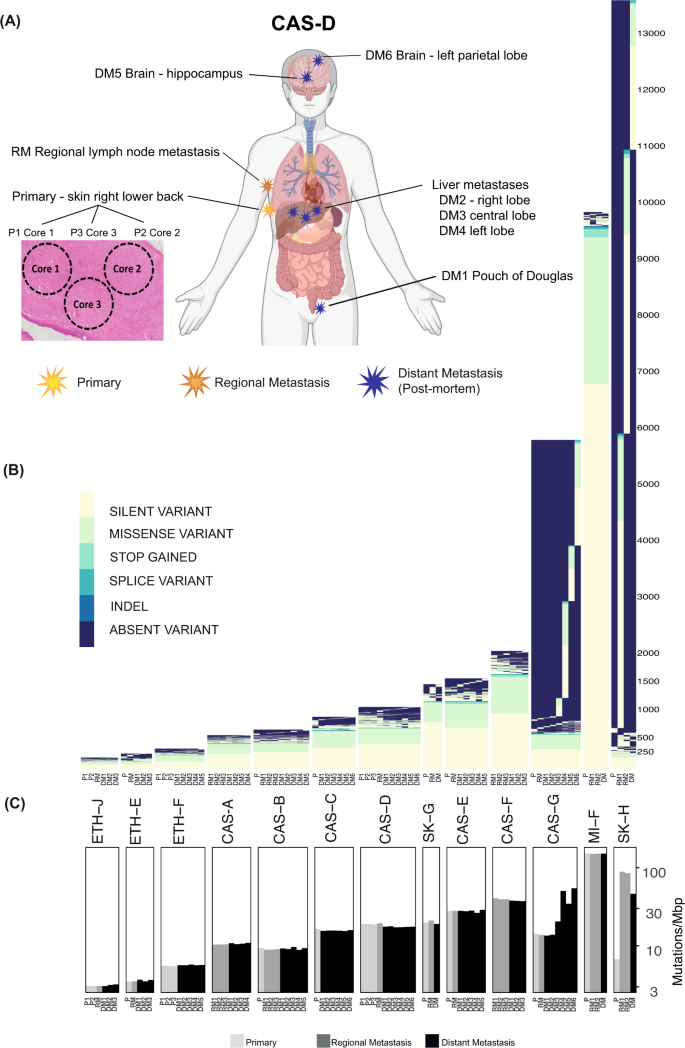 Evolution Of Late Stage Metastatic Melanoma Is Dominated By Aneuploidy And Whole Genome Doubling Nature Communications