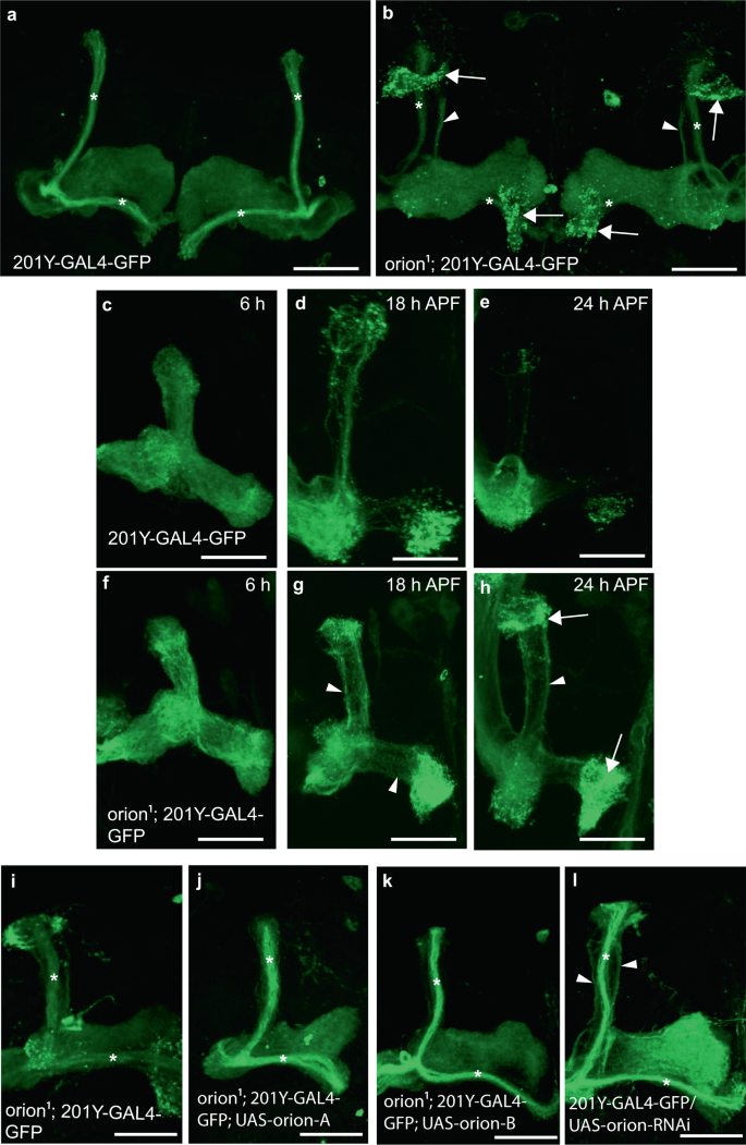 Fig. 1: The orion gene is necessary for MB remodeling.