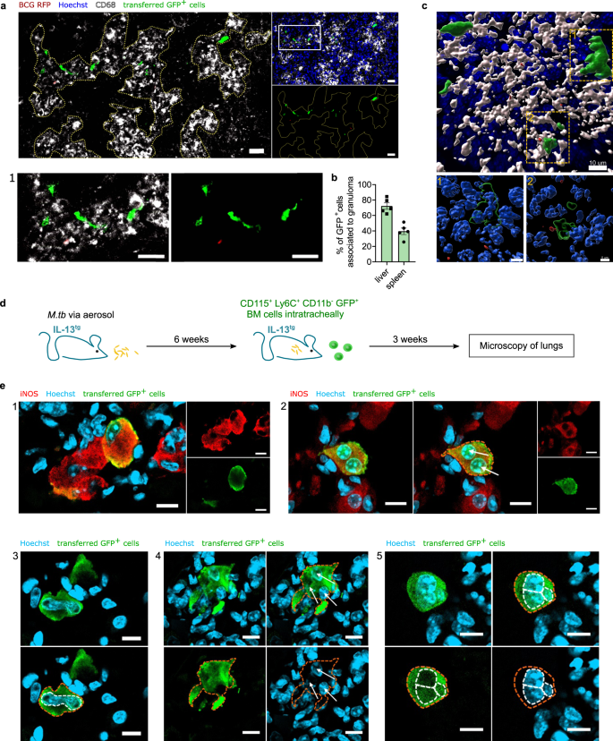 Monocyte progenitors give rise to multinucleated giant cells