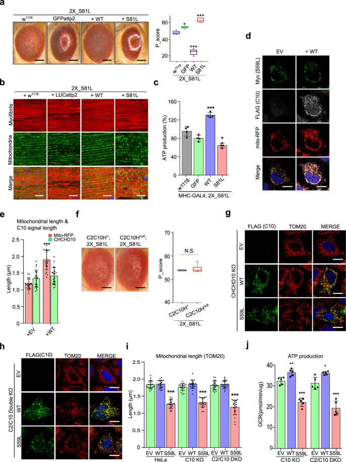 Mitochondrial G8292A and C8794T mutations in patients with Niemann‑Pick  disease type C Corrigendum in /10.3892/br.2018.1156