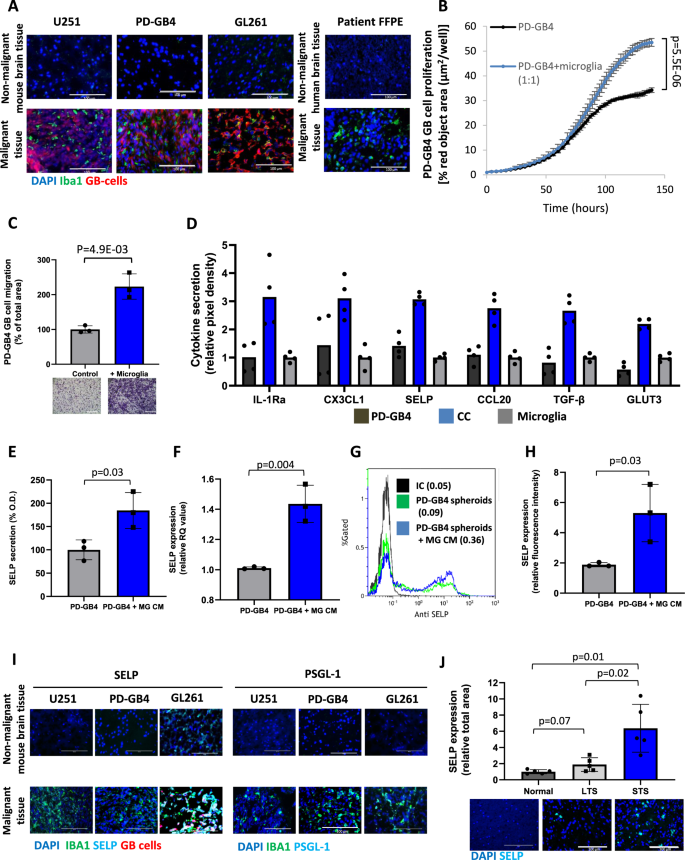 P Selectin Axis Plays A Key Role In Microglia Immunophenotype And Glioblastoma Progression Nature Communications